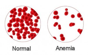 anemia y odontologia 1