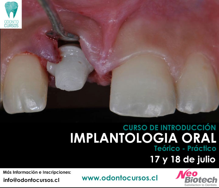 curso-implantologia-oral