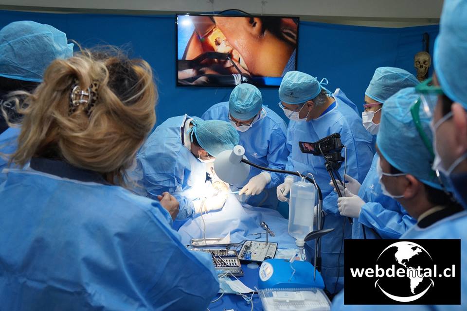 implantologia cadaveres