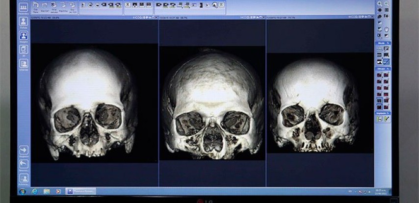 cráneos-de-San-Martín-Santa-Rosa-y-San-Juan-MasíasSmall