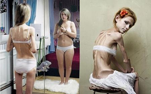 Effects of Bulimia