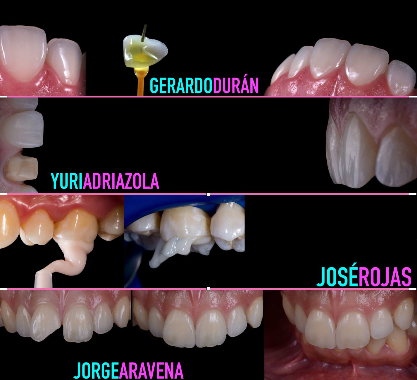 rehabilitacion oral adhesiva 2