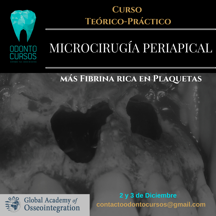 microcirugia-periapical_odontocursos