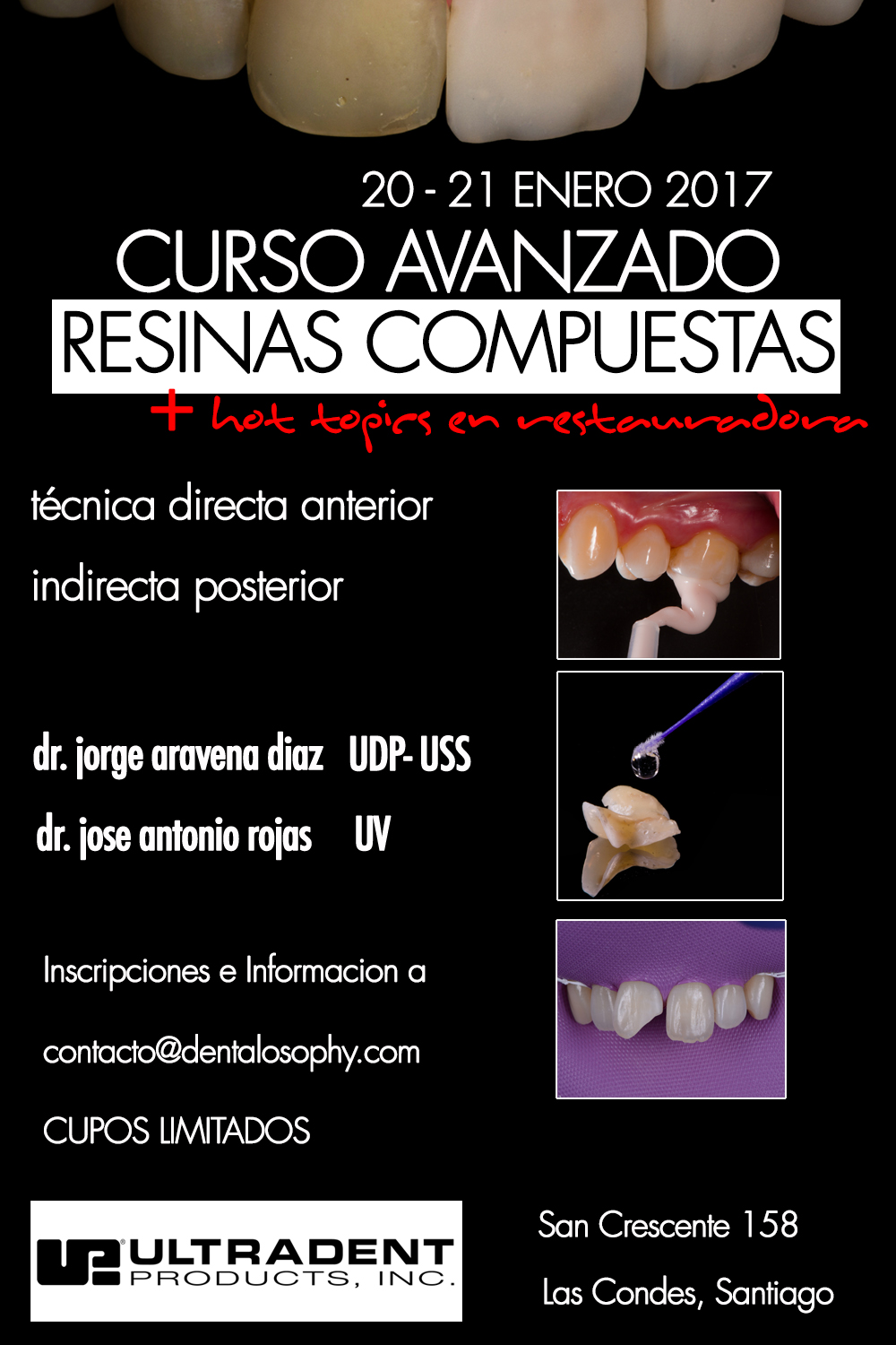 resinas-compuestas_odontologia-restauradora