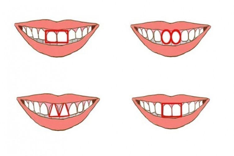 dientes-cuadrados